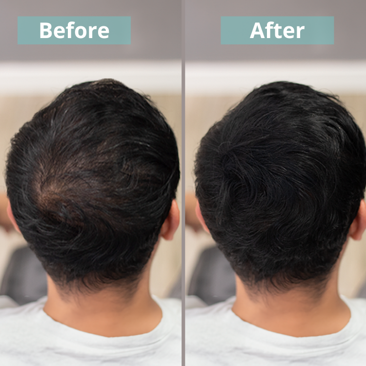 Keratin Fiber 25gr. - Vegan Formulation